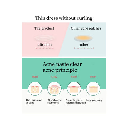 Hydrogel Acne Patch Invisible Closed Mouth