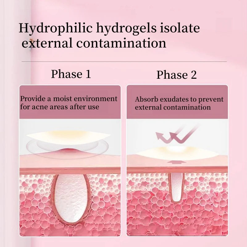 Hydrogel Acne Patch Invisible Closed Mouth