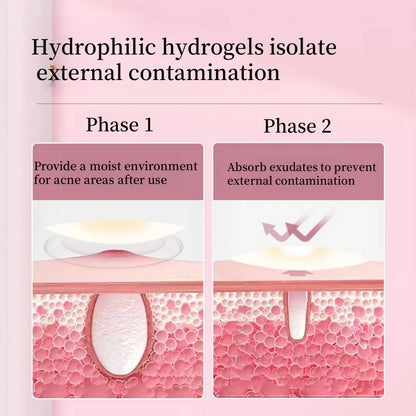 Hydrogel Acne Patch Invisible Closed Mouth