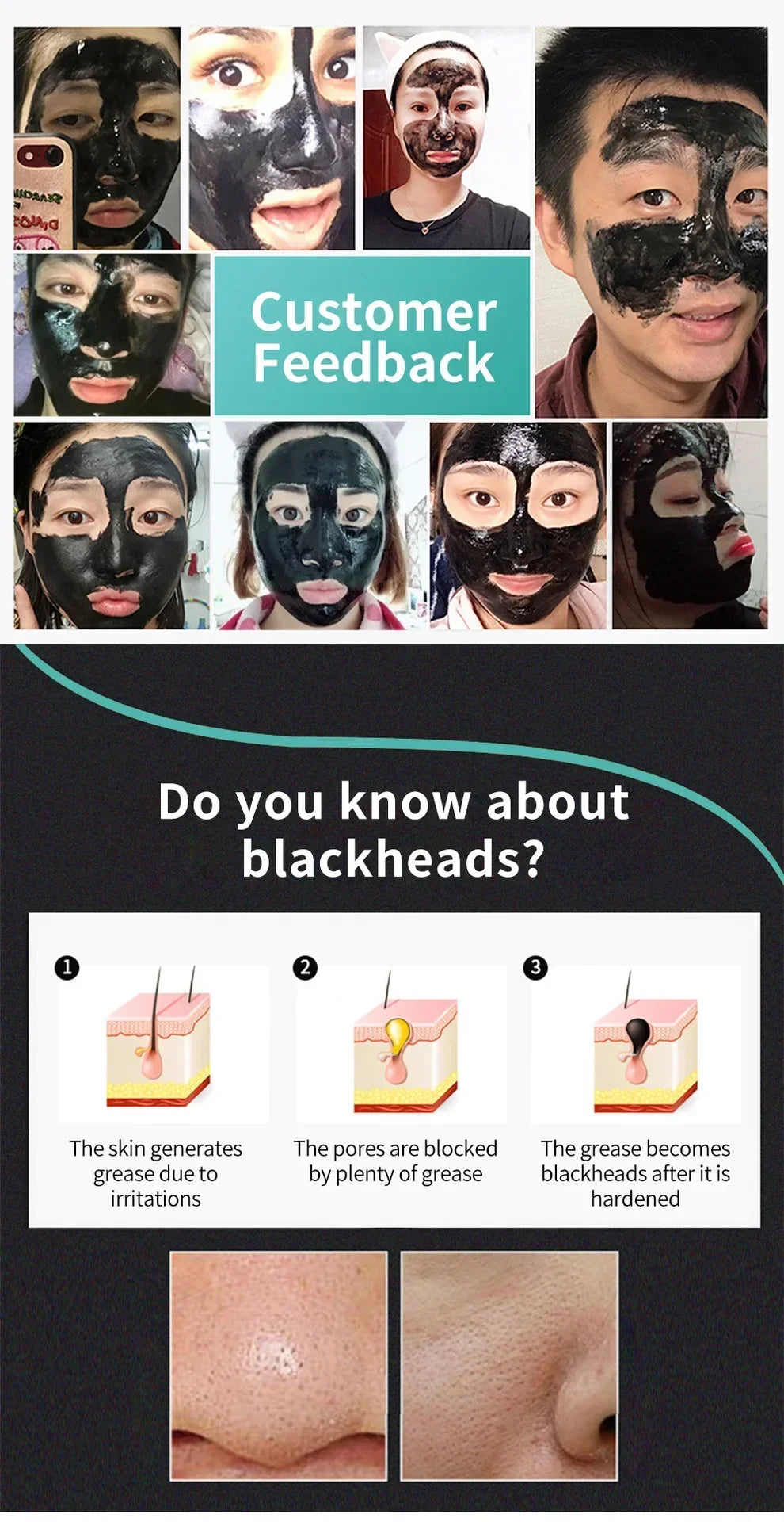 Blackhead Mask Shrinking Pore