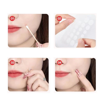 Hydrogel Acne Patch Invisible Closed Mouth