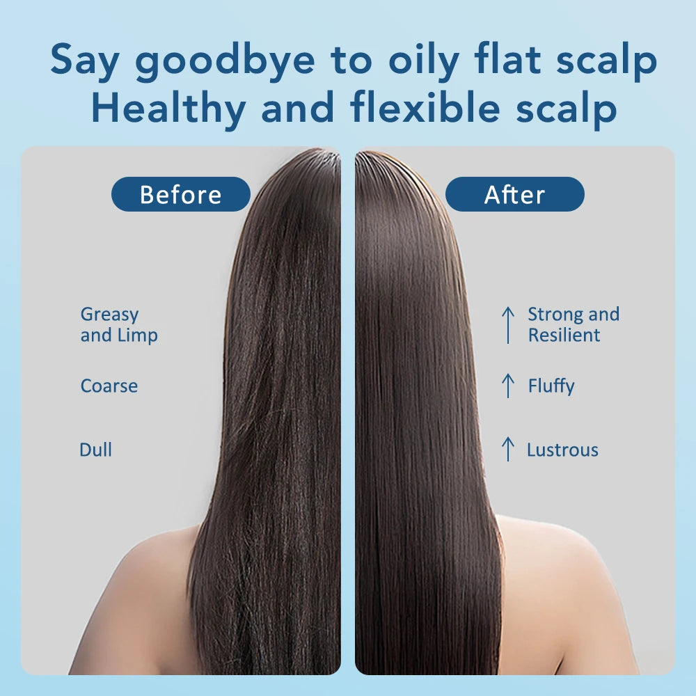 Electric Massage Comb Scalp