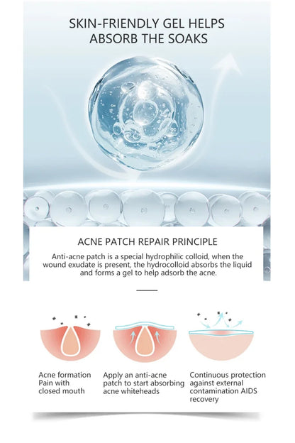 Hydrogel Acne Patch Invisible Closed Mouth